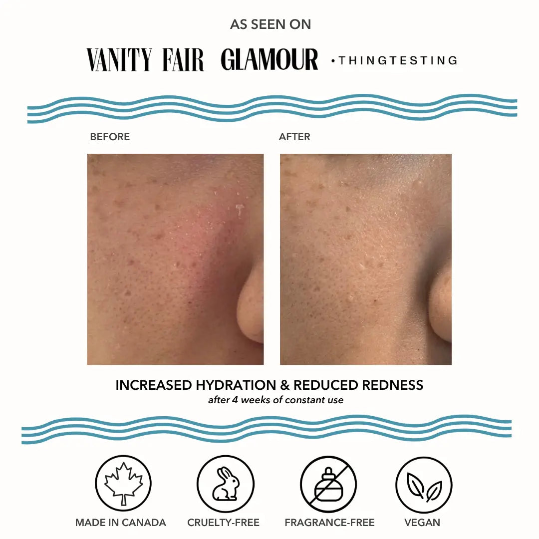 Vacation Skin Redness Recovery Overnight Mask and Moisturizer Vintage Noon Skin